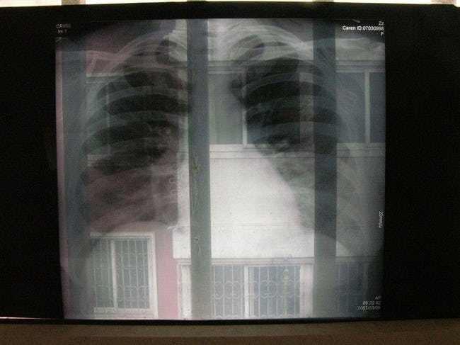 astronauts want to know what and 39 s happening to their lungs photo u1 w650q50fmjpgfitcropcropfaces