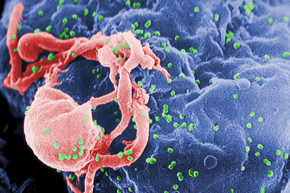Căn bệnh thế kỷ HIV/AIDS sắp sửa trở thành 'dĩ vãng'? Căn bệnh thế kỷ HIV/AIDS sắp sửa trở thành 'dĩ vãng'?