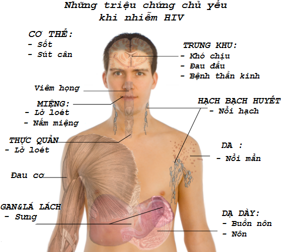 Căn bệnh thế kỷ HIV/AIDS sắp sửa trở thành 'dĩ vãng'? Căn bệnh thế kỷ HIV/AIDS sắp sửa trở thành 'dĩ vãng'?