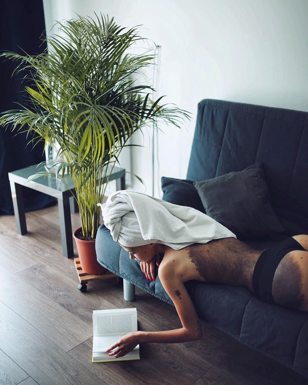 Cô gái có vết bớt khổng lồ vẫn không ngại khoe vẻ đẹp gợi cảm Cô gái có vết bớt khổng lồ vẫn không ngại khoe vẻ đẹp gợi cảm