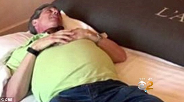Tưởng béo do bụng bia, người đàn ông tá hoả phát hiện khối u nặng 13kg trong bụng Tưởng béo do bụng bia, người đàn ông tá hoả phát hiện khối u nặng 13kg trong bụng