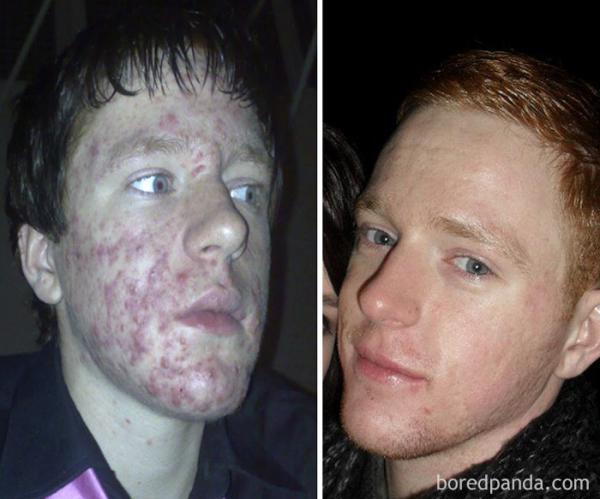 before after ugly duckling beauty transformation 08