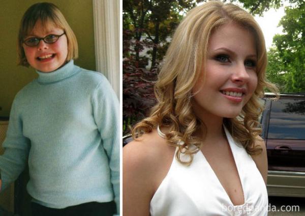 before after ugly duckling beauty transformation 09