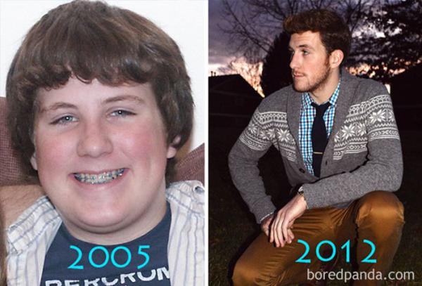before after ugly duckling beauty transformation 1