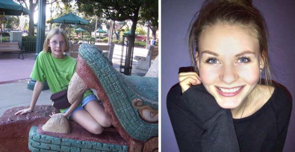before after ugly duckling beauty transformation 17 586bb2cc108fc 700