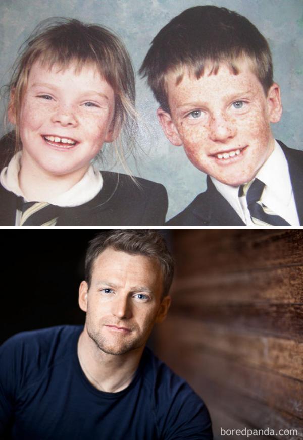 before after ugly duckling beauty transformation 2