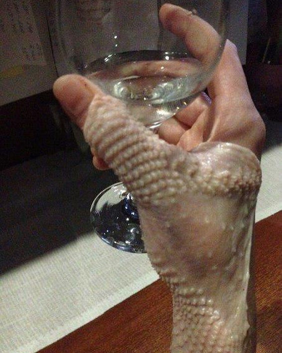8