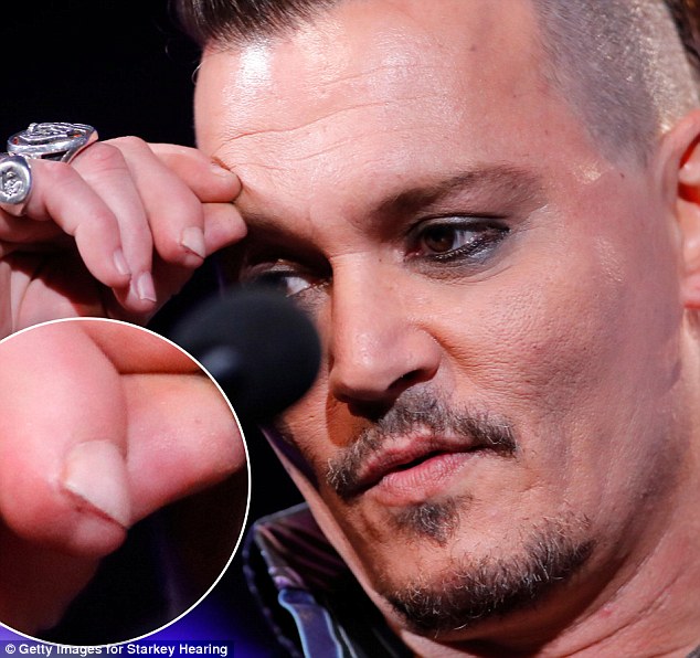 Johnny Depp đưa ra bằng chứng Amber Heard đã chém đứt một phần ngón tay anh khi cãi nhau Johnny Depp đưa ra bằng chứng Amber Heard đã chém đứt một phần ngón tay anh khi cãi nhau