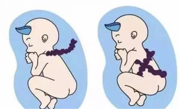 5 điều thai nhi thích làm nhất khi còn ở trong bụng mẹ 5 điều thai nhi thích làm nhất khi còn ở trong bụng mẹ