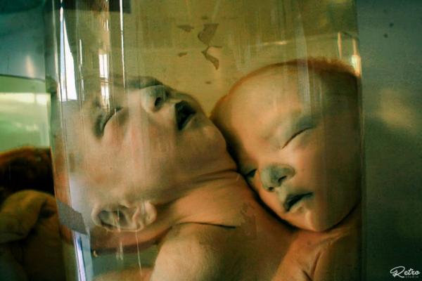 'Căn phòng quái thai' ngay giữa lòng Sài Gòn khiến người xem vừa sợ vừa xót xa 'Căn phòng quái thai' ngay giữa lòng Sài Gòn khiến người xem vừa sợ vừa xót xa