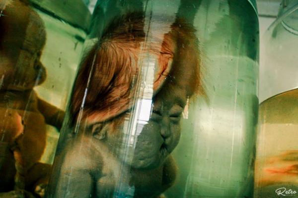 'Căn phòng quái thai' ngay giữa lòng Sài Gòn khiến người xem vừa sợ vừa xót xa 'Căn phòng quái thai' ngay giữa lòng Sài Gòn khiến người xem vừa sợ vừa xót xa