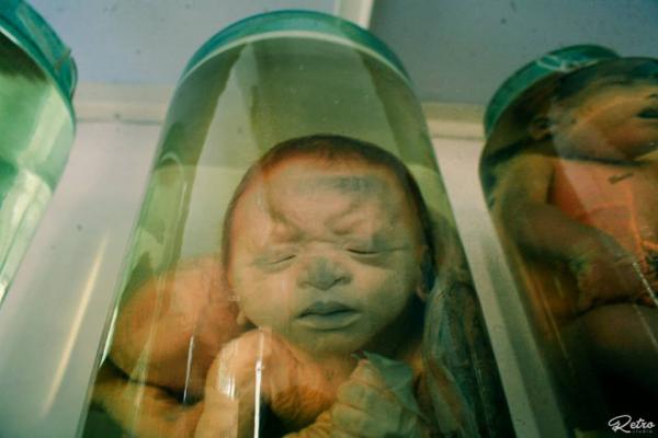 'Căn phòng quái thai' ngay giữa lòng Sài Gòn khiến người xem vừa sợ vừa xót xa 'Căn phòng quái thai' ngay giữa lòng Sài Gòn khiến người xem vừa sợ vừa xót xa
