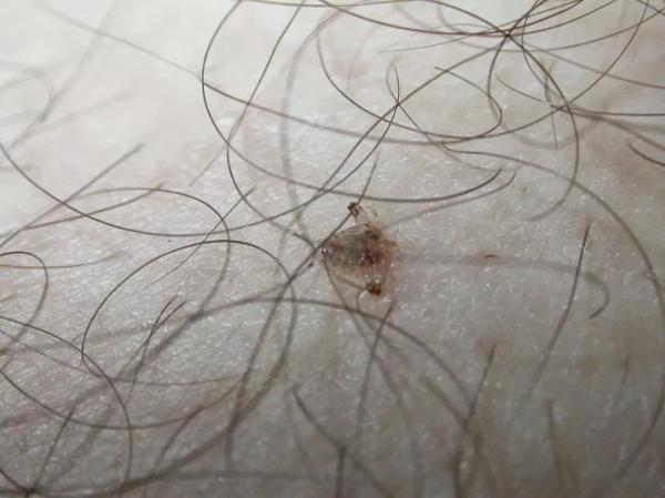 Những lầm tưởng về 'yêu' không an toàn mà rất nhiều người vẫn còn mắc phải Những lầm tưởng về 'yêu' không an toàn mà rất nhiều người vẫn còn mắc phải
