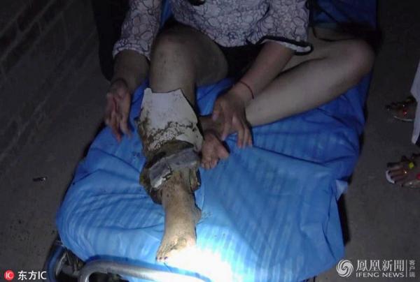 Rượu chè quá đà, một chị gái 'thọt nhẹ' chân vào hố xí phải huy động lực lượng cứu hoả đến giải cứu Rượu chè quá đà, một chị gái 'thọt nhẹ' chân vào hố xí phải huy động lực lượng cứu hoả đến giải cứu