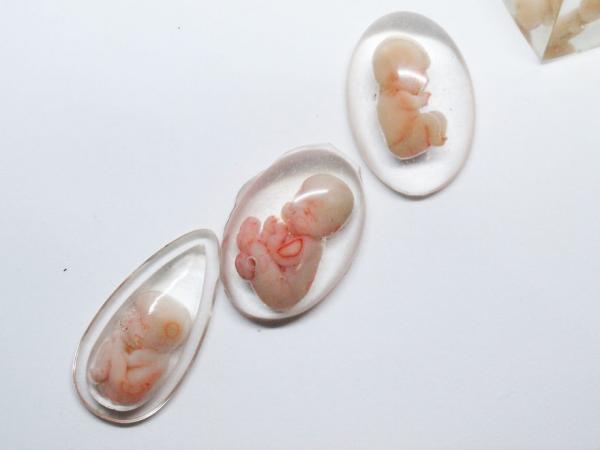 Tác phẩm điêu khắc siêu thực khiến bạn băn khoăn đó có phải người sống hay không? Tác phẩm điêu khắc siêu thực khiến bạn băn khoăn đó có phải người sống hay không?