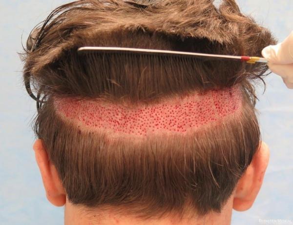 15 hình ảnh có thể khiến những người mắc hội chứng sợ lỗ phải khóc thét 15 hình ảnh có thể khiến những người mắc hội chứng sợ lỗ phải khóc thét