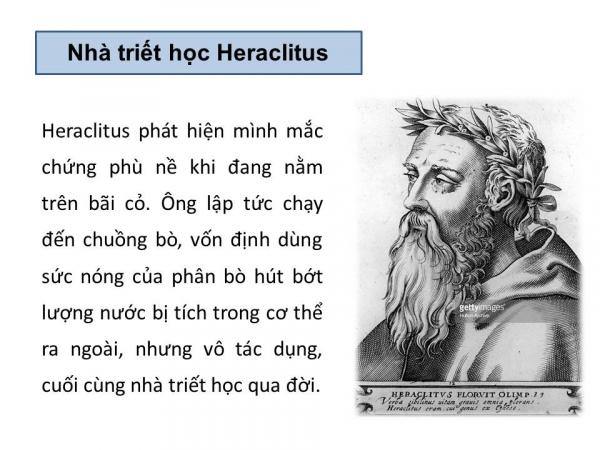 Nghìn lẻ một kiểu chết khó đỡ của người xưa (Phần 1) Nghìn lẻ một kiểu chết khó đỡ của người xưa (Phần 1)