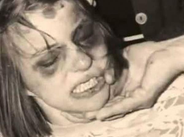 Anneliese Michel chết vì bị quỷ ám hay chứng tâm thần phân liệt? Anneliese Michel chết vì bị quỷ ám hay chứng tâm thần phân liệt?