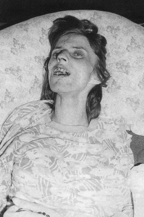 Anneliese Michel chết vì bị quỷ ám hay chứng tâm thần phân liệt? Anneliese Michel chết vì bị quỷ ám hay chứng tâm thần phân liệt?