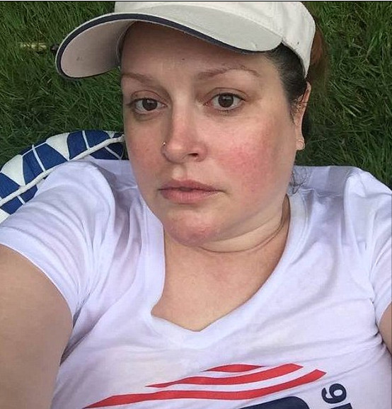 'Nàng tiên cá' Kate Fischer: Từ siêu mẫu hạng nhất trở thành người phụ nữ vô gia cư béo phì 'Nàng tiên cá' Kate Fischer: Từ siêu mẫu hạng nhất trở thành người phụ nữ vô gia cư béo phì
