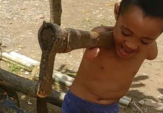 Cậu bé mất cả hai tay vẫn hăng say dùng rìu chặt củi khiến mọi người khâm phục Cậu bé mất cả hai tay vẫn hăng say dùng rìu chặt củi khiến mọi người khâm phục