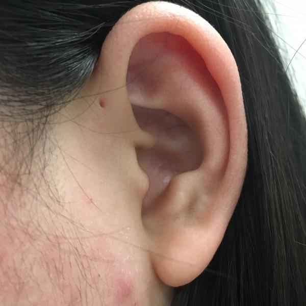 Chỉ 2% dân số thế giới có lỗ nhỏ kỳ lạ trên tai nhưng nó có gì đặc biệt thì chẳng ai biết Chỉ 2% dân số thế giới có lỗ nhỏ kỳ lạ trên tai nhưng nó có gì đặc biệt thì chẳng ai biết