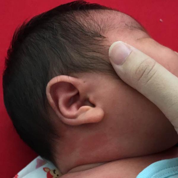 Chỉ 2% dân số thế giới có lỗ nhỏ kỳ lạ trên tai nhưng nó có gì đặc biệt thì chẳng ai biết Chỉ 2% dân số thế giới có lỗ nhỏ kỳ lạ trên tai nhưng nó có gì đặc biệt thì chẳng ai biết