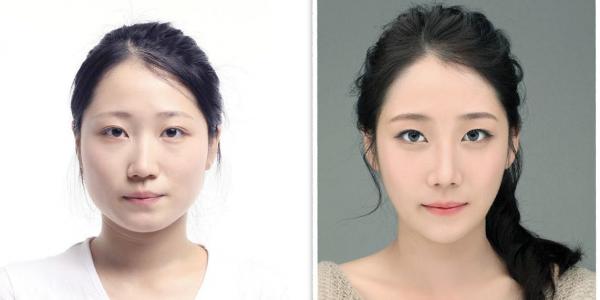 3 loại hình 'dao kéo' tại Mỹ khiến các thanh niên ở 'thiên đường thẩm mỹ' như Hàn cũng phải ghen tị 3 loại hình 'dao kéo' tại Mỹ khiến các thanh niên ở 'thiên đường thẩm mỹ' như Hàn cũng phải ghen tị