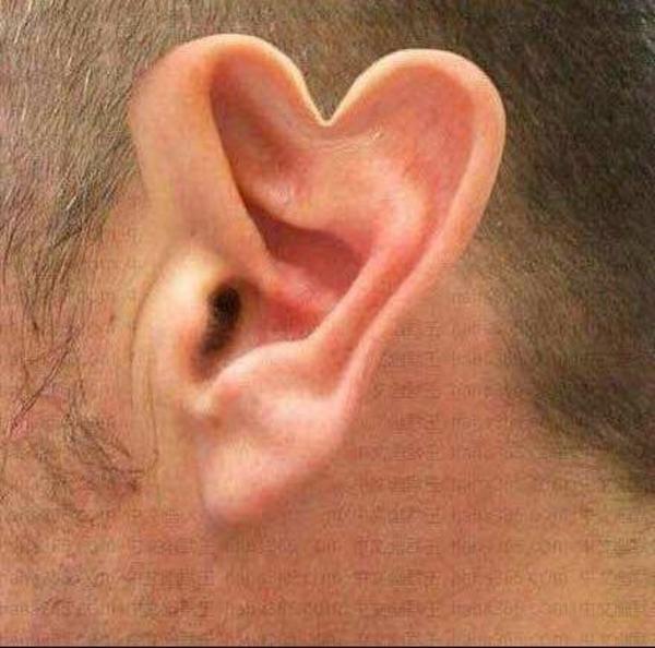 Cơ thể con người và những phiên bản biến dị kì lạ, có thể bạn chưa thấy bao giờ Cơ thể con người và những phiên bản biến dị kì lạ, có thể bạn chưa thấy bao giờ