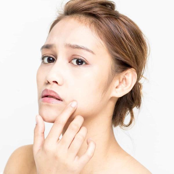 Mụn ẩn và một vài phương án chữa trị mà các nàng nên cân nhắc Mụn ẩn và một vài phương án chữa trị mà các nàng nên cân nhắc