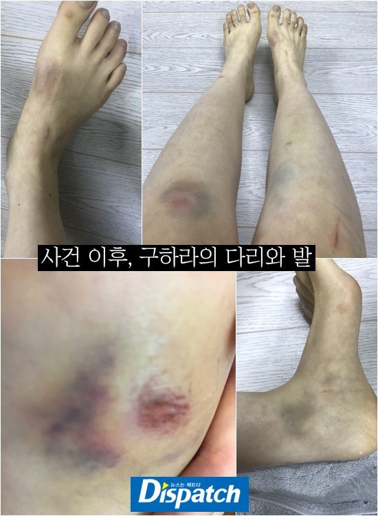 Chỉ còn thiếu 70.000 chữ kí nữa thôi, bạn trai cũ của Goo Hara có thể sẽ phải 'đi tù mọt gông' Chỉ còn thiếu 70.000 chữ kí nữa thôi, bạn trai cũ của Goo Hara có thể sẽ phải 'đi tù mọt gông'