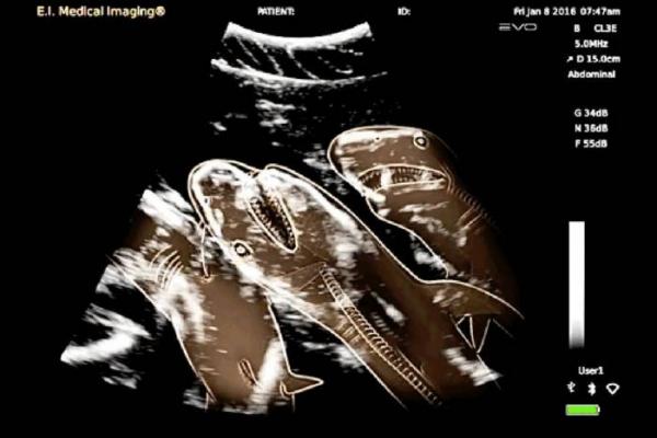 Tìm hiểu tuyệt tác của thiên nhiên qua những tấm ảnh X-quang chụp bào thai động vật Tìm hiểu tuyệt tác của thiên nhiên qua những tấm ảnh X-quang chụp bào thai động vật