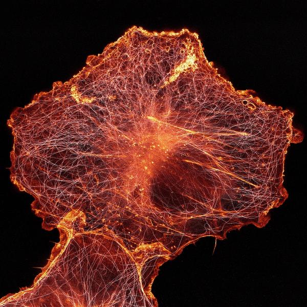 Vẻ đẹp choáng ngợp của thế giới siêu vi trong những bức ảnh thắng giải 'Nikon Small World' 2018 Vẻ đẹp choáng ngợp của thế giới siêu vi trong những bức ảnh thắng giải 'Nikon Small World' 2018