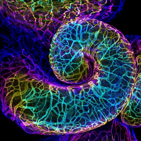 Vẻ đẹp choáng ngợp của thế giới siêu vi trong những bức ảnh thắng giải 'Nikon Small World' 2018 Vẻ đẹp choáng ngợp của thế giới siêu vi trong những bức ảnh thắng giải 'Nikon Small World' 2018
