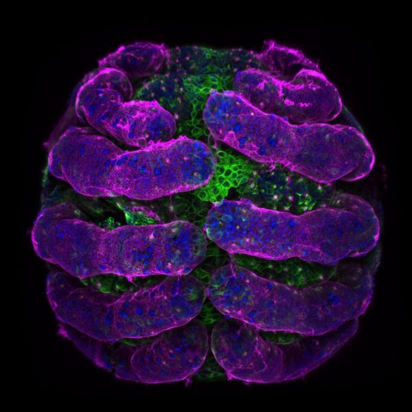 Vẻ đẹp choáng ngợp của thế giới siêu vi trong những bức ảnh thắng giải 'Nikon Small World' 2018 Vẻ đẹp choáng ngợp của thế giới siêu vi trong những bức ảnh thắng giải 'Nikon Small World' 2018