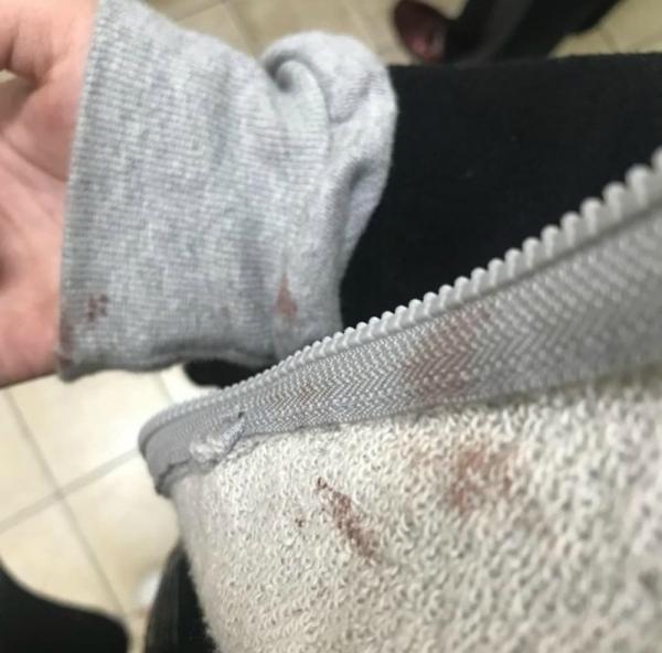 Hai phụ nữ bị bốn người đàn ông Hàn Quốc hành hung dã man vì để tóc ngắn và không trang điểm? Hai phụ nữ bị bốn người đàn ông Hàn Quốc hành hung dã man vì để tóc ngắn và không trang điểm?
