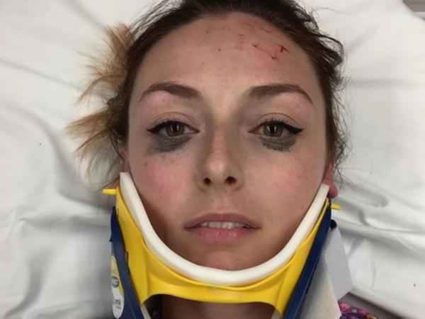 Hài hước chuyện anh khách chụp selfie trước và sau vụ tai nạn xe Hài hước chuyện anh khách chụp selfie trước và sau vụ tai nạn xe