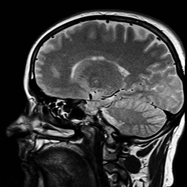Bạn nghĩ ăn thịt người như Hannibal là ngầu sao? Không đâu, có nhiều tác hại ghê rợn hơn bạn nghĩ đấy Bạn nghĩ ăn thịt người như Hannibal là ngầu sao? Không đâu, có nhiều tác hại ghê rợn hơn bạn nghĩ đấy
