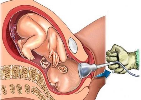 Chiến dịch 'Mẹ ơi! Đừng giết con': Mục đích nhân đạo nhưng chưa thấu đáo? Chiến dịch 'Mẹ ơi! Đừng giết con': Mục đích nhân đạo nhưng chưa thấu đáo?