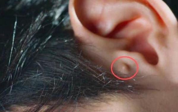 Bạn có biết: Lưu Thi Thi và Đặng Luân đều có nốt ruồi may mắn, là tướng đại phú đại quý trong tử vi Bạn có biết: Lưu Thi Thi và Đặng Luân đều có nốt ruồi may mắn, là tướng đại phú đại quý trong tử vi