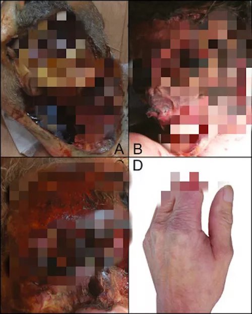 Nếu chết một mình ở nhà, thú cưng bạn nuôi sẽ ăn xác bạn bắt đầu từ mặt trở đi Nếu chết một mình ở nhà, thú cưng bạn nuôi sẽ ăn xác bạn bắt đầu từ mặt trở đi