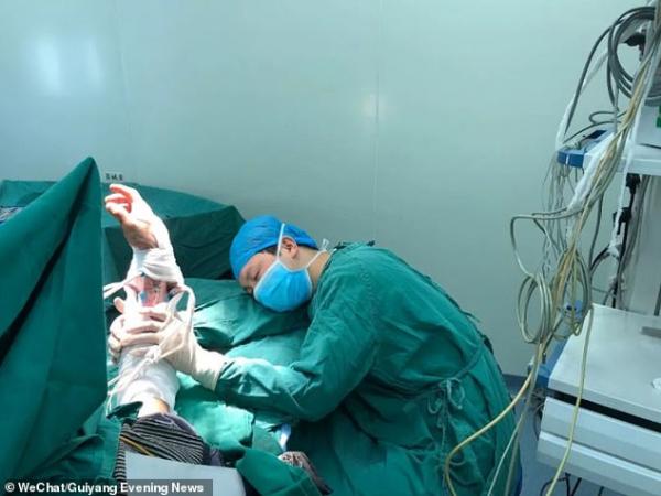 Bác sĩ phẫu thuật ngủ gục vì mệt nhưng vẫn nắm chặt cánh tay vừa nối lại cho bệnh nhân Bác sĩ phẫu thuật ngủ gục vì mệt nhưng vẫn nắm chặt cánh tay vừa nối lại cho bệnh nhân
