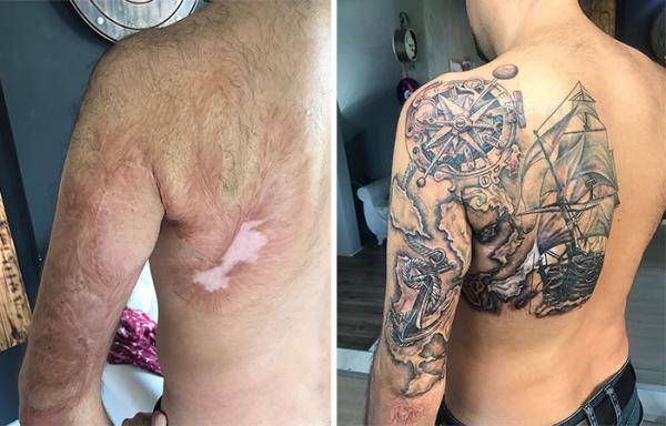30 ý tưởng dùng hình xăm che sẹo, vết bớt cực chất 30 ý tưởng dùng hình xăm che sẹo, vết bớt cực chất