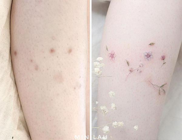 30 ý tưởng dùng hình xăm che sẹo, vết bớt cực chất 30 ý tưởng dùng hình xăm che sẹo, vết bớt cực chất