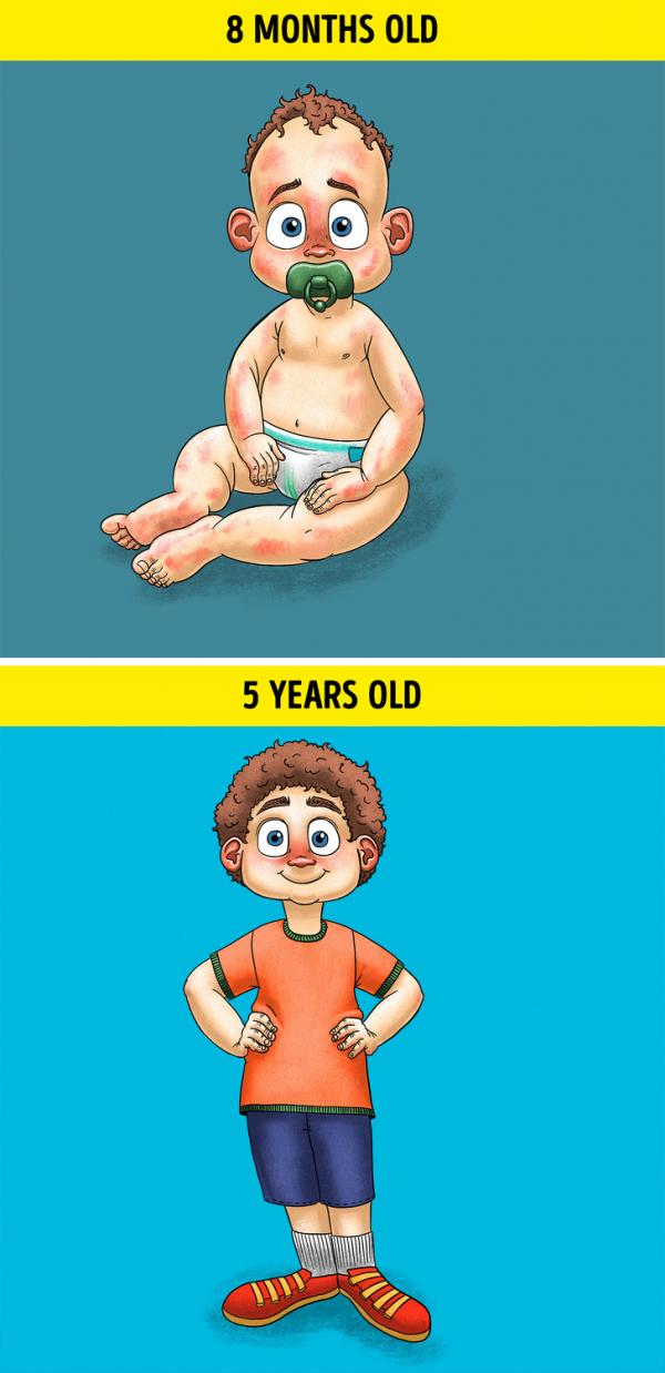 5 quy tắc đơn giản của bác sĩ nhi khoa để nuôi một em bé khỏe mạnh 5 quy tắc đơn giản của bác sĩ nhi khoa để nuôi một em bé khỏe mạnh