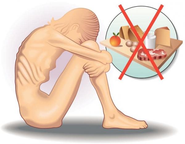 Chán ăn tâm thần - khi kì vọng về cái đẹp trở thành kẻ sát nhân thầm lặng Chán ăn tâm thần - khi kì vọng về cái đẹp trở thành kẻ sát nhân thầm lặng