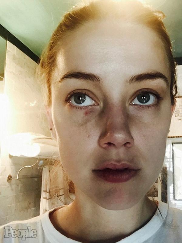 Johnny Depp tố Amber Heard tội ngoại tình và phỉ báng chồng, yêu cầu bồi thường 50 triệu USD Johnny Depp tố Amber Heard tội ngoại tình và phỉ báng chồng, yêu cầu bồi thường 50 triệu USD