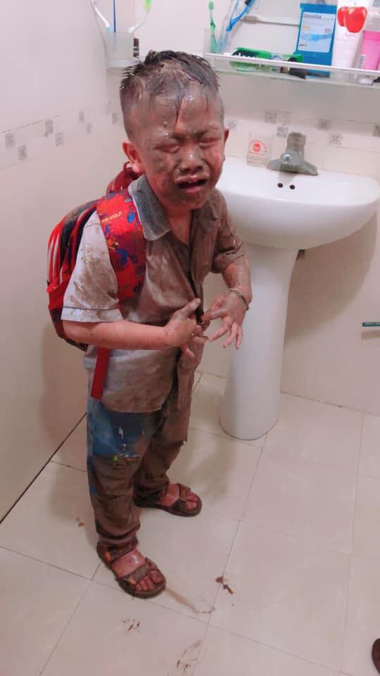 Chuyện có thật: Tan học không về lại la cà, chú bé tiểu học suốt ngày bị rơi xuống cống Chuyện có thật: Tan học không về lại la cà, chú bé tiểu học suốt ngày bị rơi xuống cống