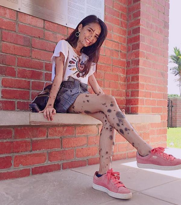 Những người có ngoại hình khác biệt có thể bạn chưa từng nhìn thấy Những người có ngoại hình khác biệt có thể bạn chưa từng nhìn thấy