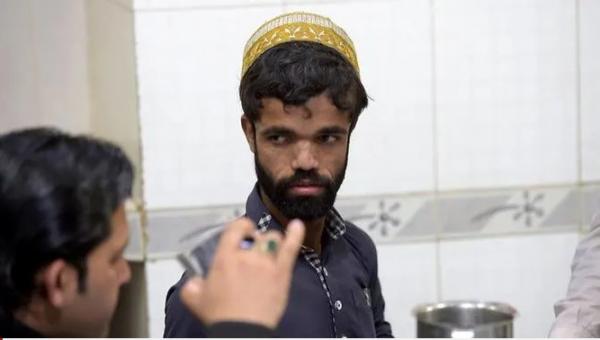 Song trùng là có thật: Anh phục vụ Pakistan nổi tiếng vì giống hệt Tyrion Lannister của 'Game Of Thrones' Song trùng là có thật: Anh phục vụ Pakistan nổi tiếng vì giống hệt Tyrion Lannister của 'Game Of Thrones'